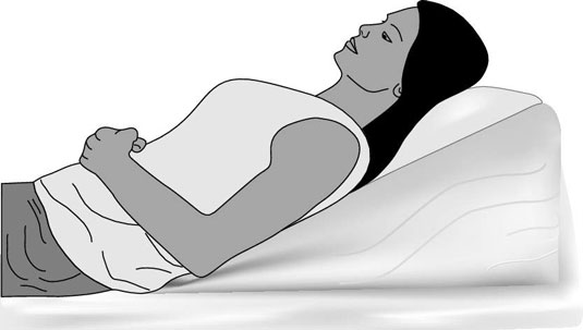 酸逆流を減らすための最良の睡眠位置